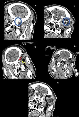 A Novel Porcine Model for the Study of Cerebrospinal Fluid Dynamics: Development and Preliminary Results